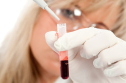 Лабораторное исследование крови во время беременности