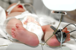 Помещение недоношенного ребёнка в отделение интенсивной терапии